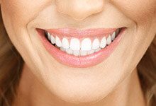bright white smile after cosmetic dentistry